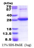 Human NT5E / eNT / CD73 Protein (Recombinant His)