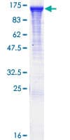 Human RABGAP1 Protein (Recombinant GST)