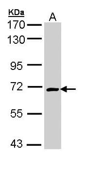 Polyclonal Rabbit anti-Human CRMP1 Antibody (WB)
