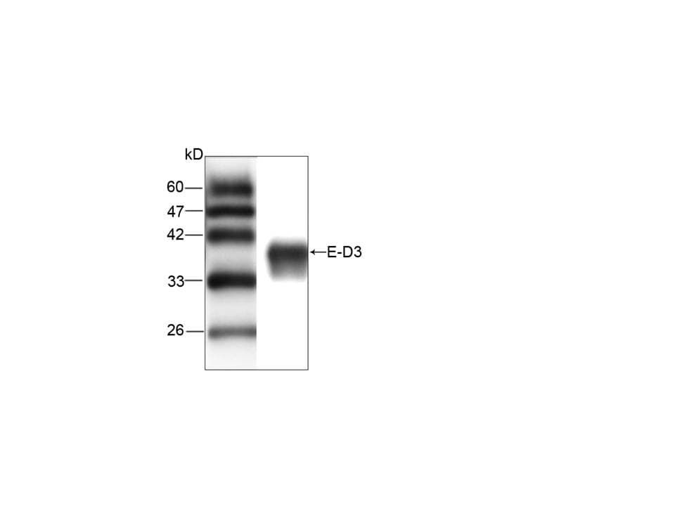 Monoclonal Mouse anti-Japanese Encephalitis Virus Japanese Encephalitis Virus Antibody (aa291-402, WB)