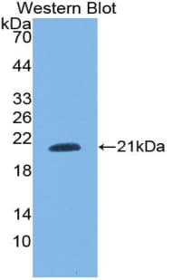 SNRPC / U1C Antibody (aa2-159)
