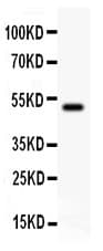 JUP/CTNNG/Junction Plakoglobin Antibody (aa556-745)