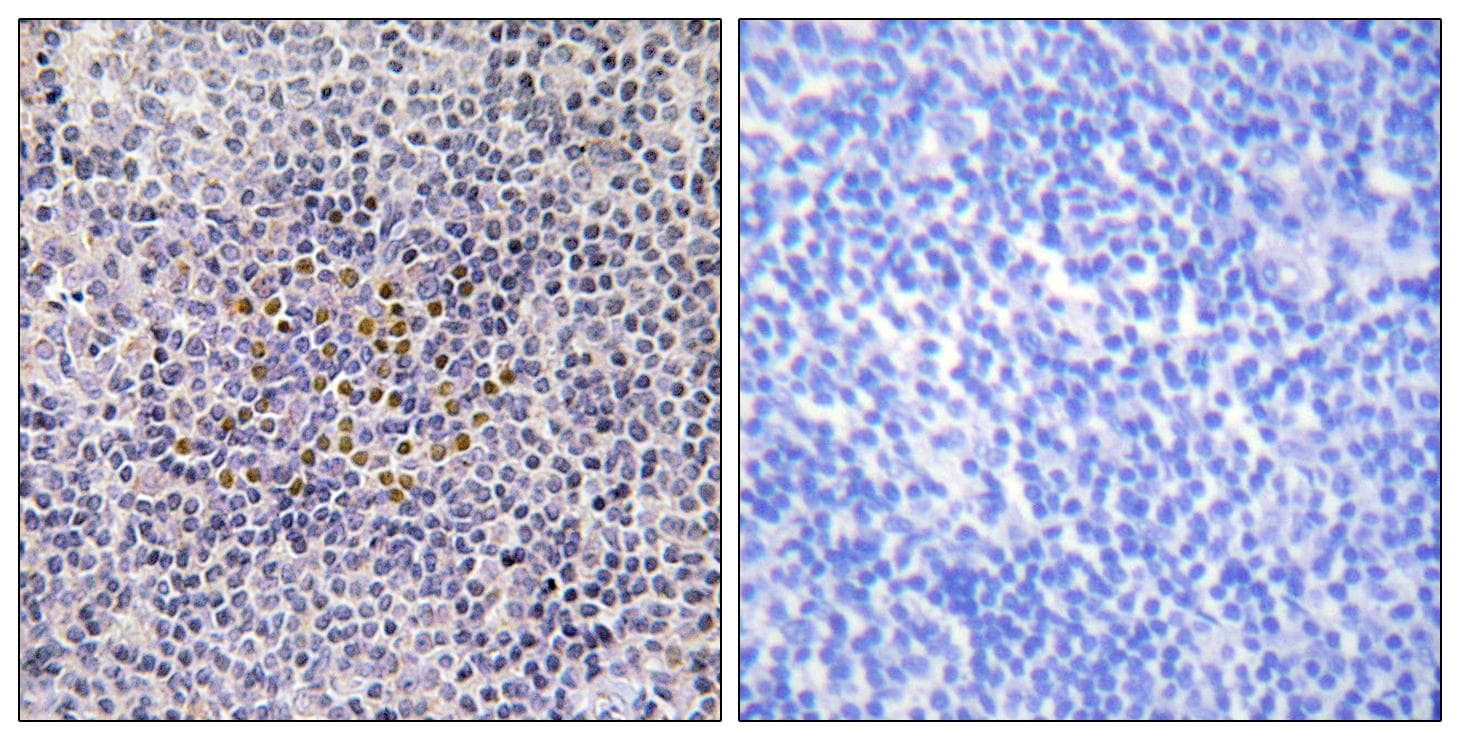 Polyclonal Rabbit anti-Human XRCC3 Antibody (IHC, IF)