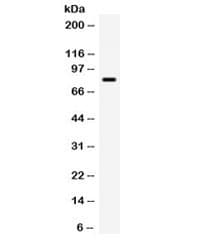 Polyclonal Rabbit anti-Human ADRBK2 / GRK3 Antibody (WB)