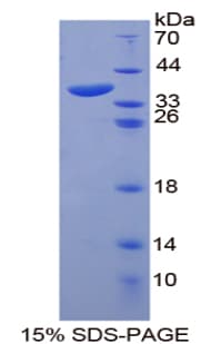 Human ANK1 / Ankyrin Protein (Recombinant His-T7)