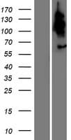 Human TBC1D3H Protein (Over-Expression Lysate Myc-DDK (Flag))