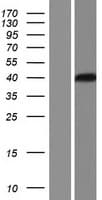 NEK6 Protein (Over-Expression Lysate Myc-DDK (Flag))
