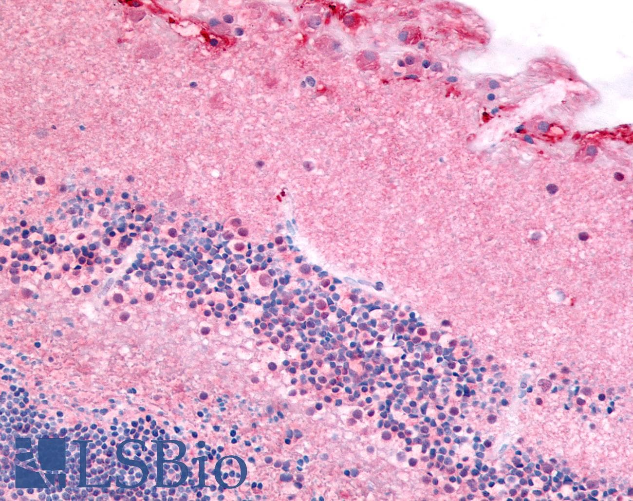 IHC-plus™ PDE6A / PDE6 Alpha Antibody (N-Terminus)