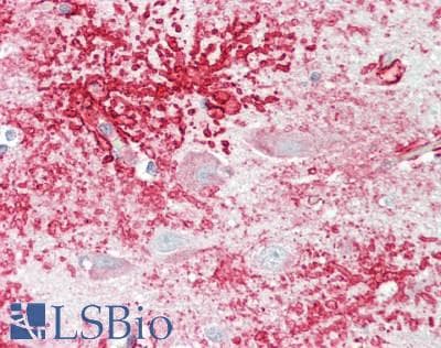 IHC-plus™ RPS6KB1 / P70S6K / S6K Antibody (aa355-404)