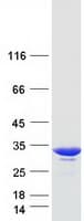 Human GSTO1 Protein (Recombinant Myc-DDK (Flag))