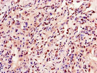 Polyclonal Rabbit anti-Human ANKRD23 / DARP Antibody