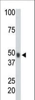 CHKA / CK / Choline Kinase Antibody (aa64-94)