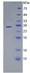 Human ANGPTL8 / Betatrophin Protein (Recombinant His, N-Terminal)