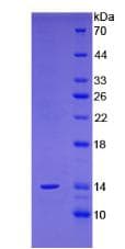 Human PSCA Protein (Recombinant 6His, N-terminus)