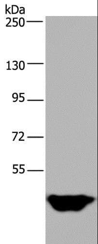 Polyclonal Rabbit anti-Human MTF2 / PCL2 Antibody (WB)