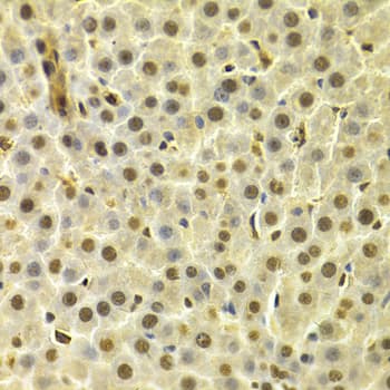 DTNBP1 / Dysbindin Antibody
