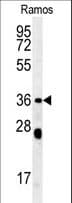 NCF1 / p47phox / p47 phox Antibody (aa26-52)