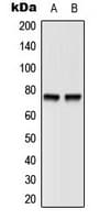 BTK Antibody (phospho-Tyr551)