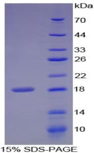 Human MMP3 Protein (Recombinant His, N-Terminal)