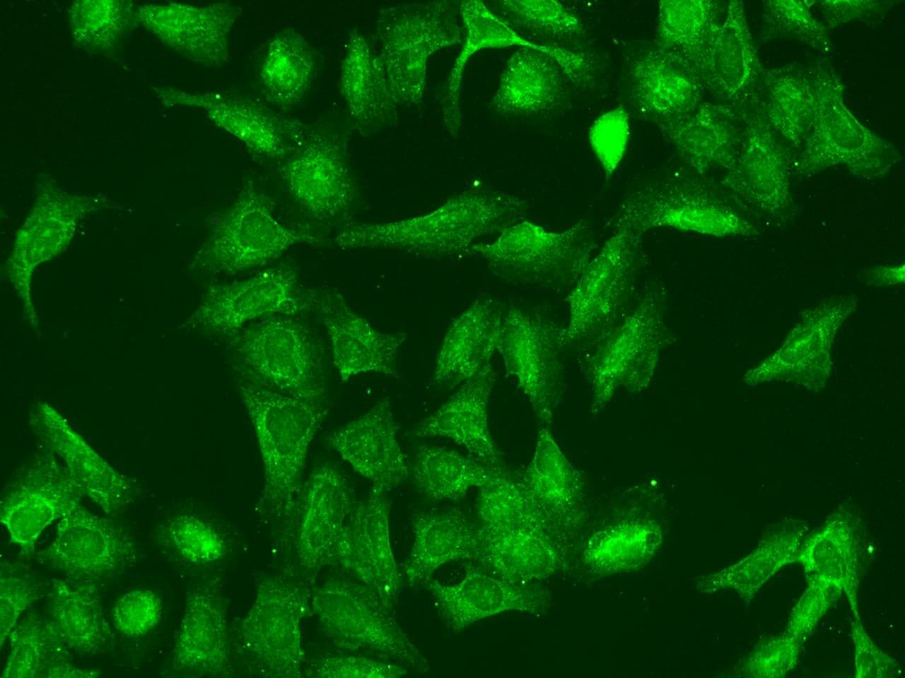 RGS5 Antibody
