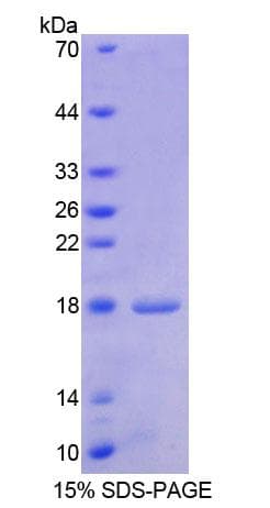 Human HBEGF / HB EGF Protein (Recombinant His)