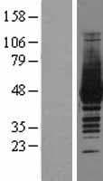 CKM / Creatine Kinase MM Protein (Over-Expression Lysate Myc-DDK (Flag))