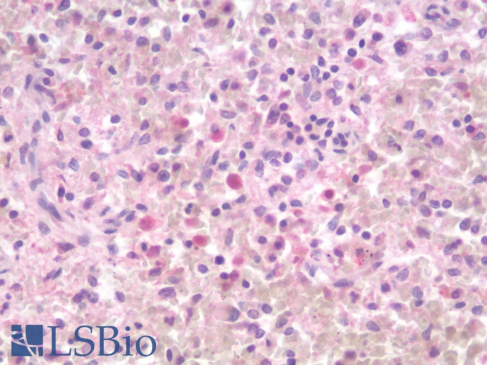 IHC-plus™ LAG3 Antibody