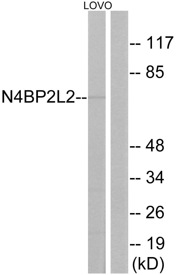 N4BP2L2 Antibody (aa358-407)