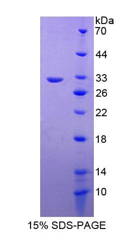 Human RAB5A / RAB5 Protein (Recombinant His-S)