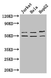 Polyclonal Rabbit anti-Human YTHDF2 Antibody