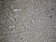 MBP / Myelin Basic Protein Antibody (aa182-197)