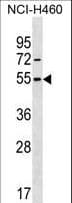 Polyclonal Rabbit anti-Human MI-ER1 / ER1 Antibody (aa214-242, WB)