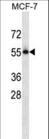 PVRL3 / Nectin-3 Antibody (aa507-536)