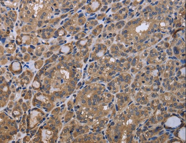 MYD118 / GADD45B Antibody