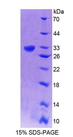 Human GRIK2 / GLUR6 Protein (Recombinant His-T7)