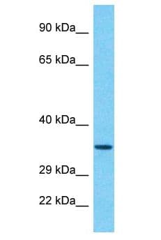 Polyclonal Rabbit anti-Human RBMY1A1 Antibody (aa307-356, WB)
