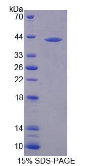Human MFI2 / p97 Protein (Recombinant His, N-Terminal)