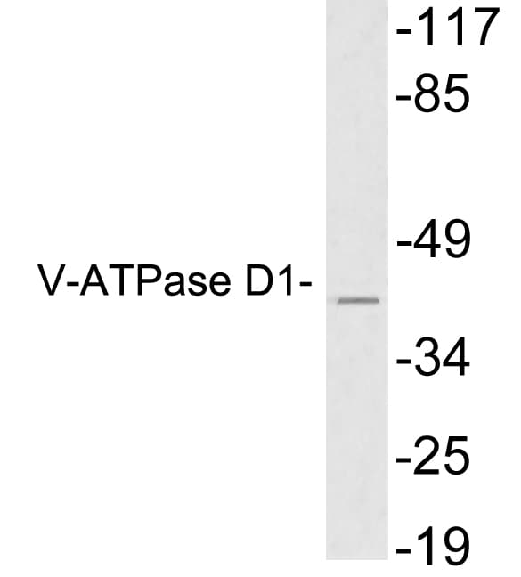 Polyclonal Rabbit anti-Human ATP6V0D1 Antibody (aa221-270, WB)