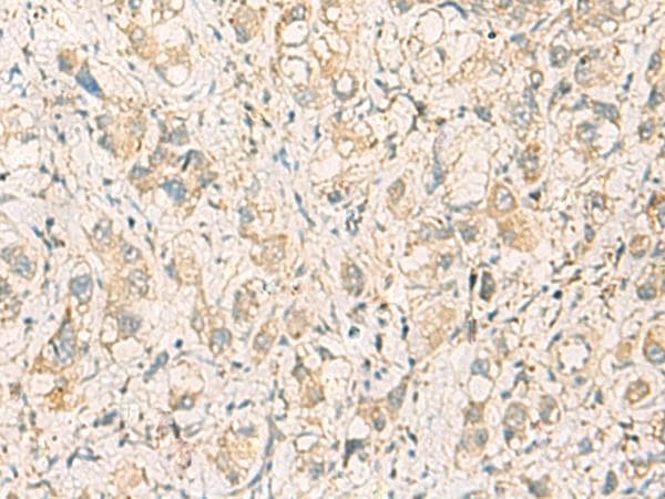 F11R / JAM1 Antibody
