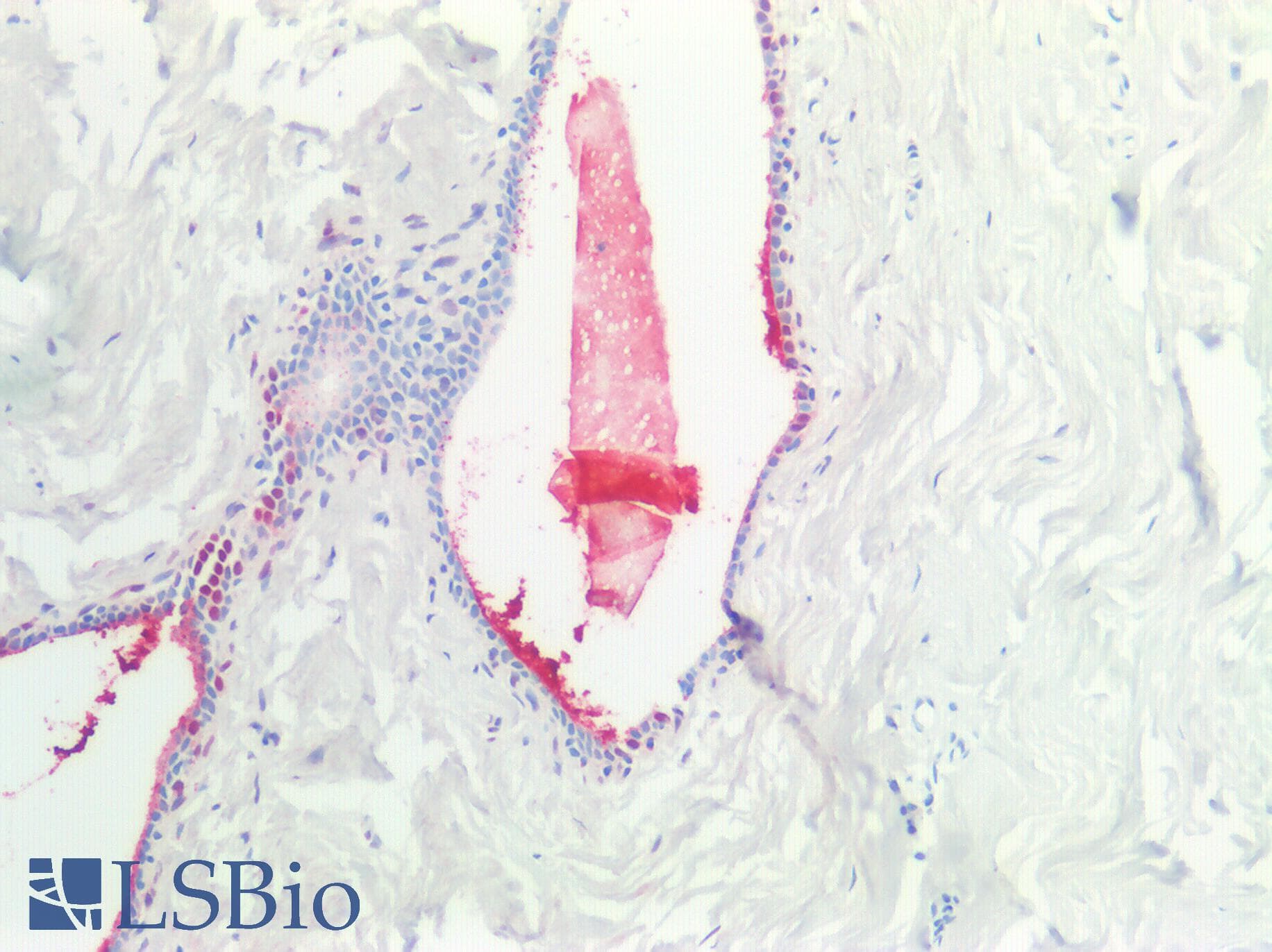 PathPlus™ SCGB2A2 / Mammaglobin A Antibody