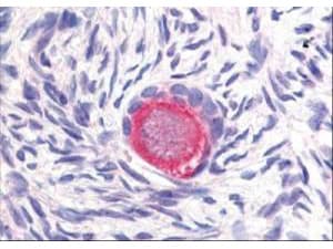 DLL4 Antibody (Internal)