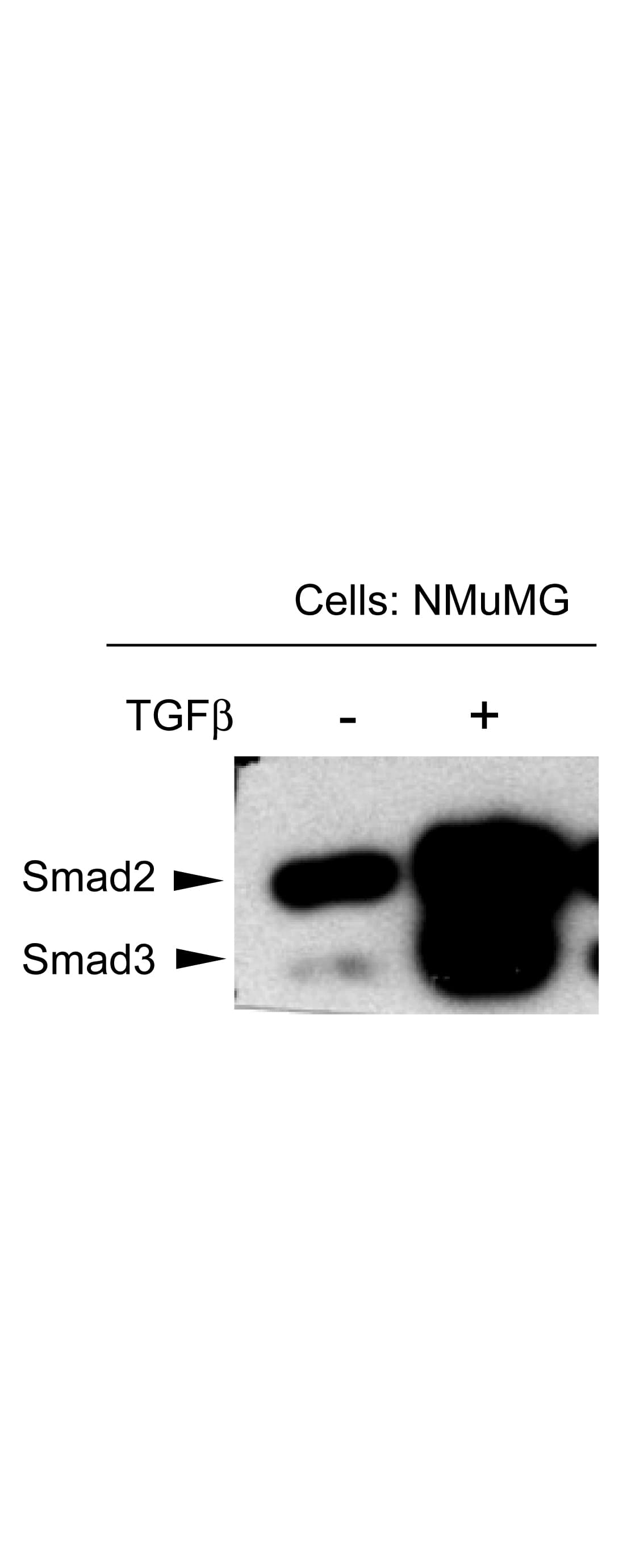 SMAD3 Antibody (phospho-Thr179)