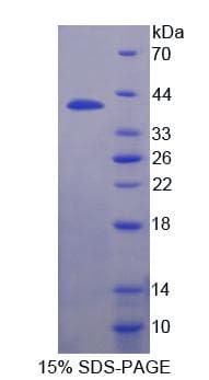 Human ICSBP / IRF8 Protein (Recombinant His-T7)