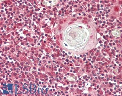 IHC-plus™ NFAT4 / NFATC3 Antibody (clone 3A12)