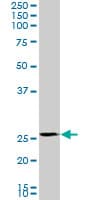 PMM2 Antibody (clone 2A5)