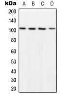 NFKB1 / NF-Kappa-B Antibody (phospho-Ser932)