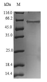 Human RNF41 Protein (Recombinant GST, N-terminus)
