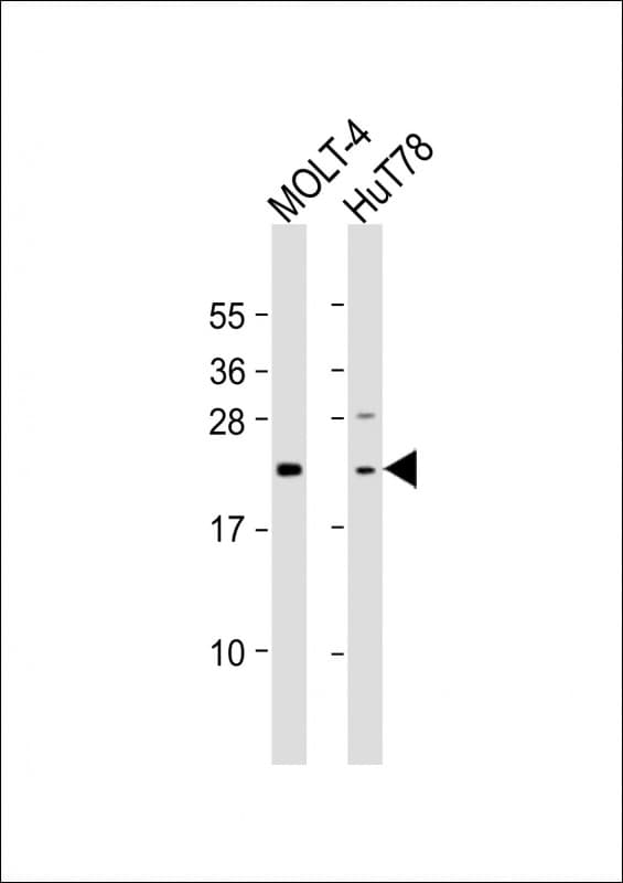DLEU7 Antibody (aa58-89)