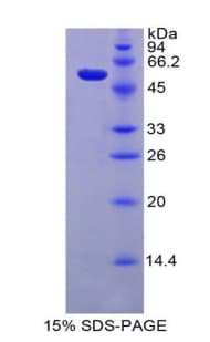 Pig TFF3 / Trefoil Factor 3 Protein (Recombinant His, N-Terminal)
