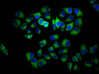 Polyclonal Rabbit anti-Human INPP5E Antibody (IHC, IF)